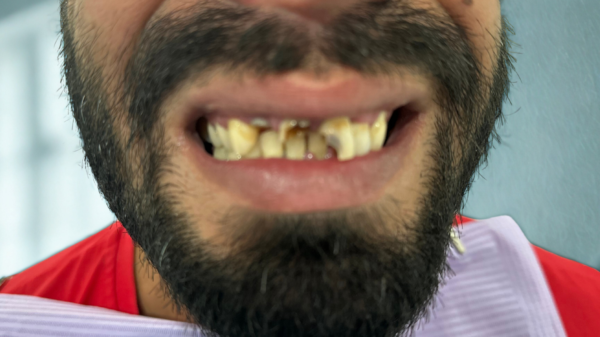 domina as variacões Anatómicas! (11) domina as variacões Anatómicas! (11)